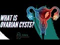 WHAT IS AN OVARIAN CYSTS?