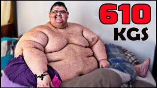 देखिये दुनिया के 10 सबसे मोटे लोग कैसे अपनी ज़िन्दगी जीतें है 10 Fattest People in The World