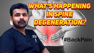 What happens in Spine Degeneration?|முதுகெலும்பு சிதைவில் என்ன நடக்கிறது| Dr. Vignesh Pushparaj