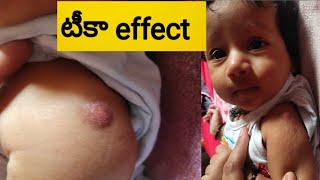 వేద కి 3rd month vaccination ఇప్పించాం// tika problem// tika side effects