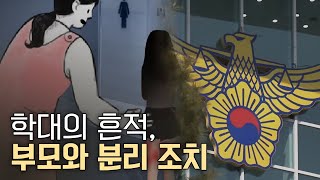 단독ㅣ5살 어린이 몸에 '멍 자국'..학대 여부 수사ㅣMBC충북NEWS