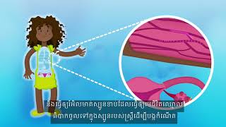 ថ្នាំចាក់ពន្យារកំណើត (Injection)