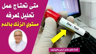 متى تحتاج عمل تحليل لمعرفه مستوى الزنك بالدم | اهمية تحليل الزنك فى الجسم