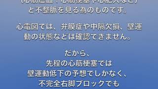 シリーズ心電図について①プロローグ