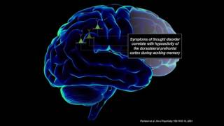 Prefrontal Cortical Circuits in Schizophrenia Molecular Vulnerabilities & Treatments