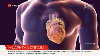 Порятунок для людей із хворобами серця: в Україні з'явилося безкоштовне стентування