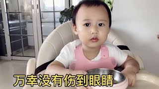 妈妈的一时疏忽让宝宝受伤了！这回真要破相了，妈妈好自责【米酒mama】