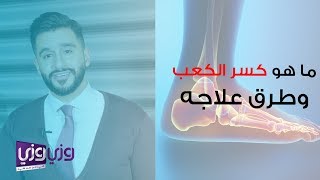 ما هو كسر الكعب وطرق علاجه