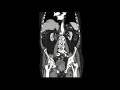 hydronephrosis caused by foley catheter insertion