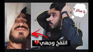 شوفوا وش صار بسبب الاهمال !💔