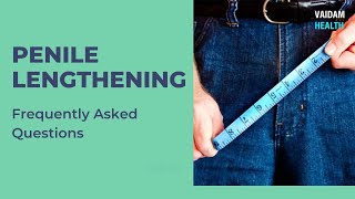 Penile Lengthening- Frequently Asked Questions