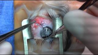 Short tag noose adjustable suture technique after strabismus surgery