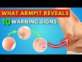 What Your Armpit Tells About Your Health: 10 Warning Signs | Lump | Lymph Nodes | Armpit Pain