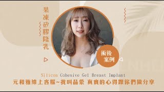 隆乳專家元和雅（我是元和雅線上客服~我叫品縈）我用真實的心得跟你們做分享！#果凍隆乳