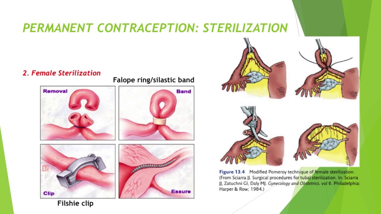 Family Planning Birth Control Methods Youtube