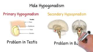 Male Hypogonadism - simply explained