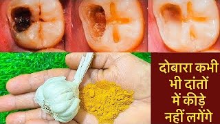 2 मिनट में दाँत का दर्द और कीड़ा बाहर निकालने का अचूक उपाय Get Rid of Tooth Cavity