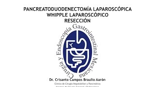 Laparoscopic Pancreatoduodenectomy. Laparoscopic Whipple Procedure. Resection