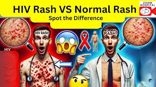 HIV Rash vs. Normal Rash: How to Tell the Difference