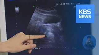 건강보험 확대…내년 2월부터 부인과 초음파 비용 1/2 줄어 / KBS뉴스(News)