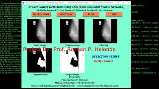 Python Code for Breast Cancer Detection Using CNN | IEEE Based Project #PythonSourceCode