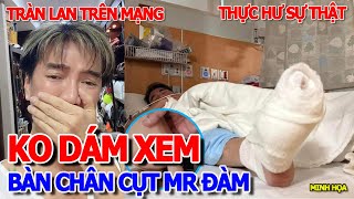 BẤT NGỜ - TRÀN LAN HÌNH ẢNH BÀN \