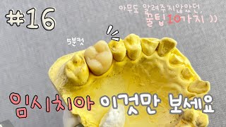 임시치아 빠르게 잘 깍는법 ? 어렵지 않아요 :) • 쉽게 완벽정복가능 • 꿀팁공유