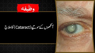 Ankhon Ke Motiya Ka Qurani Ilaj | Treatment of Eye Cataract | Wazifa