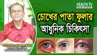 চোখের পাতা ফুলার আধুনিক চিকিৎসা | Chalazion Treatment | Dr. Md. Abdul Mannan | Health Tv Bangla