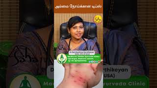 Natural cure for Ammai disease  or Ammai Noi || Dr. K. Santhoshima BSMS, DPK, DP(USA