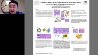 Quantifying Hidden Architectural Patterns in Metaplastic Tumors by Calculating the (QSI)