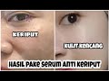 wajib pake serum anti keriput anti flek di usia 25 tahun!!