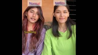 NORMAL VS MED RIZZ PART-3 #trending #nursing #mbbs #doctor   @Ichbin-Sristi