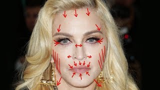 Removing MADONNA'S Plastic Surgery