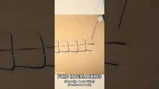Ford Interlocking Suture Pattern (Reverdin - Lock Stitch - Continuous Lock) #shorts #memes #medical