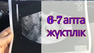 ЖҮКТІЛІК КҮНТІЗБЕСІ 6-7 апта         жүктіліктің 6-7аптасы