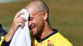 Agar suffers gruesome injury after dropping own brother | Marsh One-Day Cup 2019