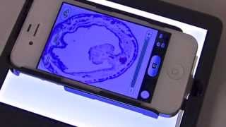 ProScope Micro Mobile Samples