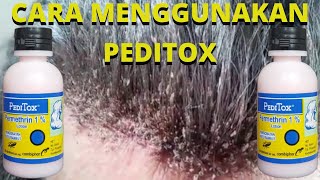 Cara Menggunakan Peditox Obat Kutu Rambut || Solusi Terbaik