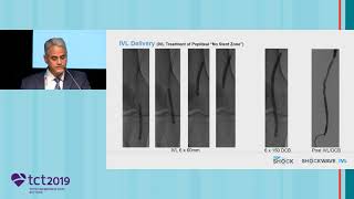 TCT2019 TopShock Symposium: “CLI: Look Mom, No Recoil” Presentation by Dr Peter Soukas