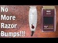 How To Stop Getting Razor Bumps With A Dry Shave How To Stop Getting Razor Bumps With A Dry Shave