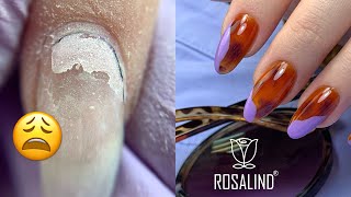 How to Fix Product Lifting | Tortoise Shell Nail Art with Rosalind Gel Polishes | Amazon Gel Kit