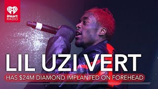 Lil Uzi Vert Had A $24M Pink Diamond Implanted On His Forehead | Fast Facts