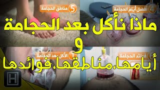 ماذا نأكل بعد الحجامة وكل المعلومات عن أيامها ومناطقها وفوائدها