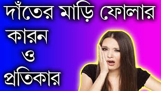 দাঁতের মাড়ি ফোলা ও ব্যথা কমানোর উপায় | Gum pain treatment by Smile BD