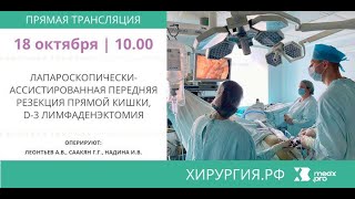 Лапароскопически-ассистированная передняя резекция прямой кишки, D-3 лимфаденэктомия