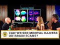 Can we see mental illness on brain scans?  @DrDanielAmen_BrainHealth