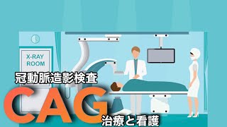 【6分でわかる！】冠動脈造影検査のリスクと看護