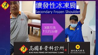 冰凍肩，Frozen Shoulder