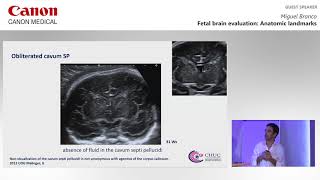 ISUOG 2019   Miguel Branco on utilizing ultrasound imaging techniques during fetal brain evaluation